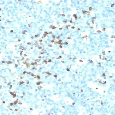 آنتی بادی Lambda Immunoglobulin Light Chain کلون LCN-2 برند PathoSage