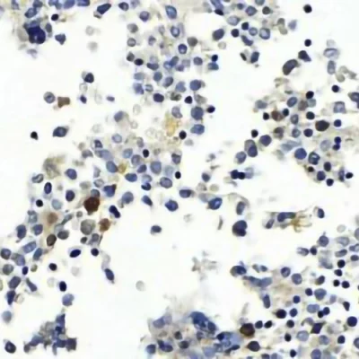 آنتی بادی LMO2 کلون 1A9-1 برند PathoSage