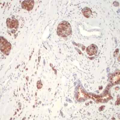آنتی بادی Mammaglobin A کلون 304-1A5 برند PathoSage