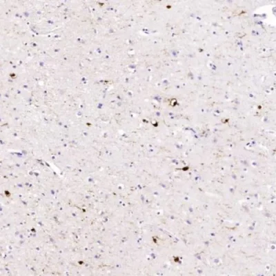 آنتی بادی MBP(Myelin Basic Protein) کلون MBP/4277R برند PathoSage