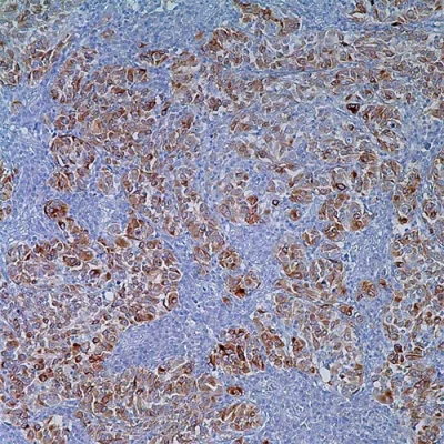 آنتی بادی MELAN A(MART1) کلون A103 برند PathoSage