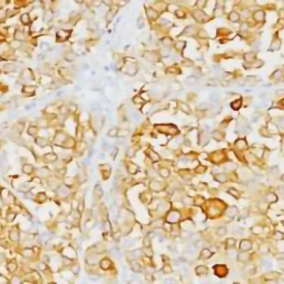 آنتی بادی MELAN A(MART1) کلون M2-9E3 برند PathoSage