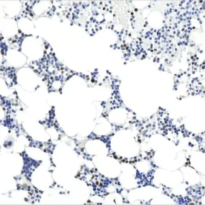 آنتی بادی MLH1 کلون ES05 برند PathoSage