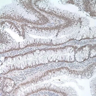 آنتی بادی MLH1 کلون G168-728 برند PathoSage