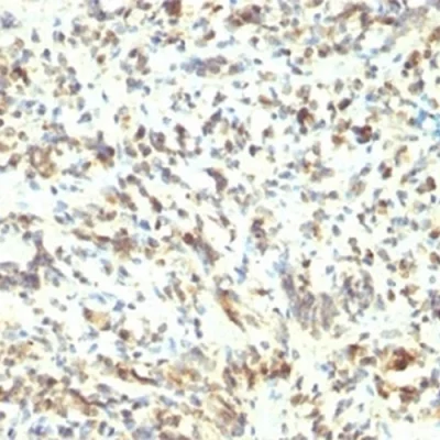 آنتی بادی MyoD1 کلون 5.8A برند PathoSage