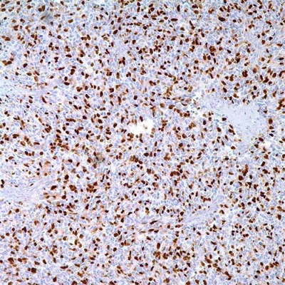 آنتی بادی Myogenin کلون F5D برند PathoSage
