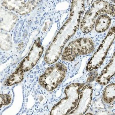 آنتی بادی Napsin A کلون MX0165 برند PathoSage