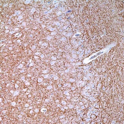 آنتی بادی Neurofilament 70/200 kDa کلون 2F11 برند PathoSage