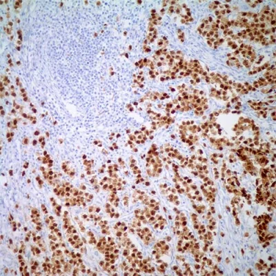 آنتی بادی 45933 کلون C-10 برند PathoSage