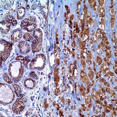 آنتی بادی P120(Delta Catenin 1) کلون 15D2 برند PathoSage