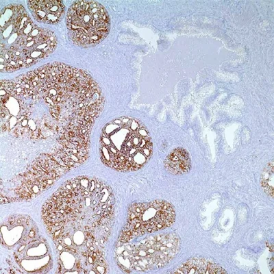 آنتی بادی P504S(AMACR) کلون 13H4 برند PathoSage