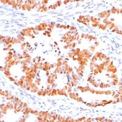 آنتی بادی P53 کلون BP53-12 برند PathoSage