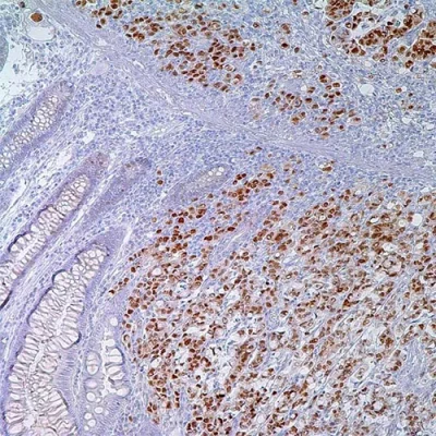 آنتی بادی P53 کلون DO7 برند PathoSage