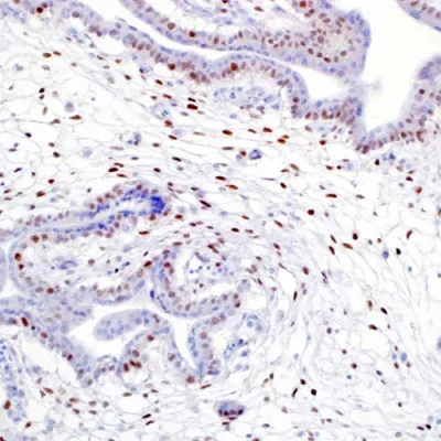 آنتی بادی P57(KIP2) کلون KP10(57P06) برند PathoSage