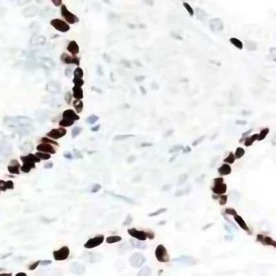 آنتی بادی P63 کلون 4A4 برند PathoSage