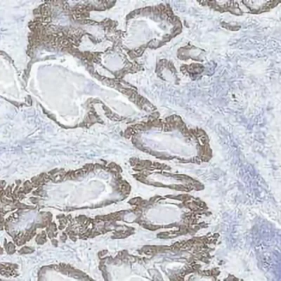 آنتی بادی P63 کلون TP63/1423 برند PathoSage