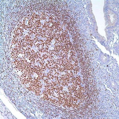 آنتی بادی PAX5 کلون 24 برند PathoSage