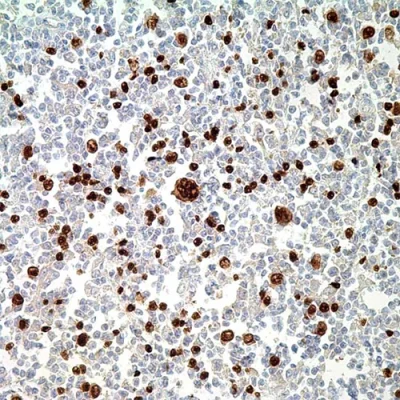 آنتی بادی PAX5 کلون MX017 برند PathoSage