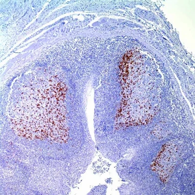 آنتی بادی PD1 کلون NAT105 برند PathoSage
