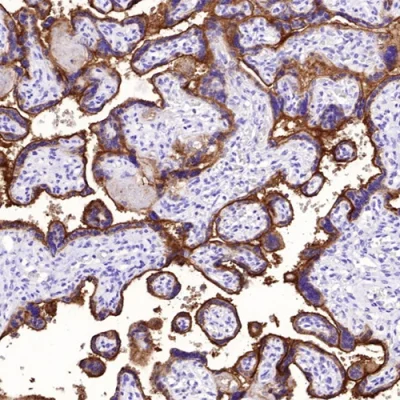 آنتی بادی PDL1(CD274) کلون 4772 برند PathoSage