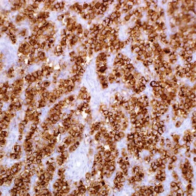 آنتی بادی Plap(Placental Alkaline Phosphatase) کلون ALP/81112R برند PathoSage