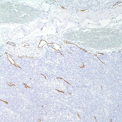 آنتی بادی Podoplanin کلون 1433 برند PathoSage