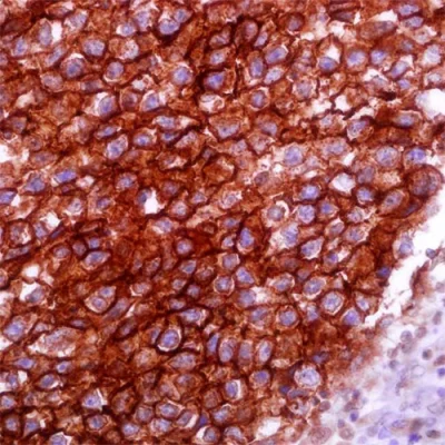 آنتی بادی Podoplanin کلون D2-40 برند PathoSage