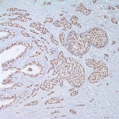 آنتی بادی PR(Progesterone Receptor) کلون Y85 برند PathoSage