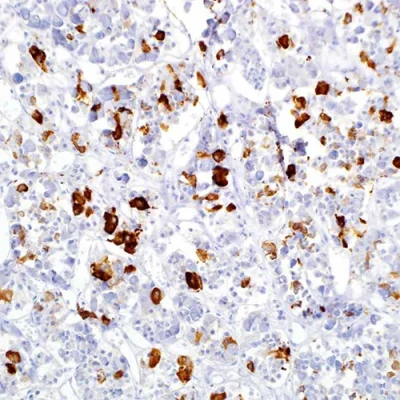 آنتی بادی Prolactin کلون Polyclonal برند PathoSage
