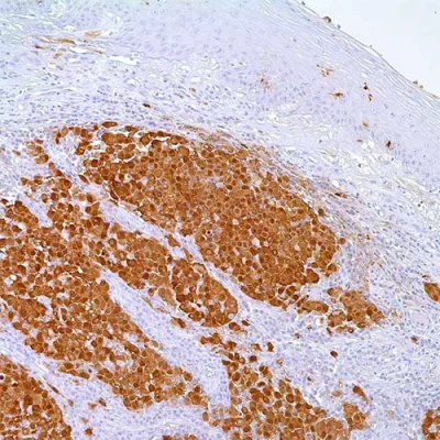 آنتی بادی S100 Protein کلون 4C4.9 برند PathoSage