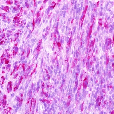 آنتی بادی S100 Protein کلون Polyclonal برند PathoSage