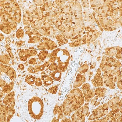 آنتی بادی SMAD4(Dpc4) کلون B8 برند PathoSage