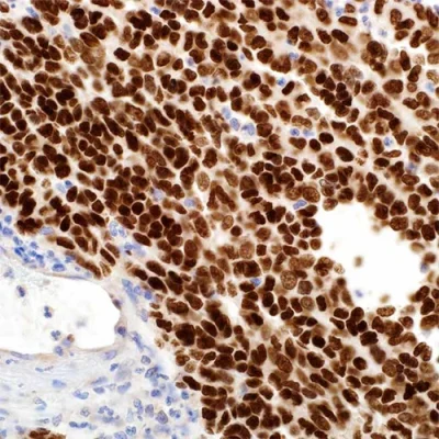 آنتی بادی SOX10 کلون 1074 برند PathoSage