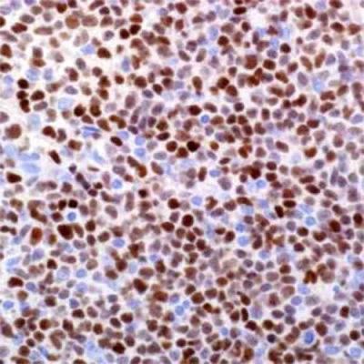 آنتی بادی SOX11 کلون ILQ158 برند PathoSage