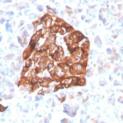 آنتی بادی Synaptophysin کلون 4503R برند PathoSage