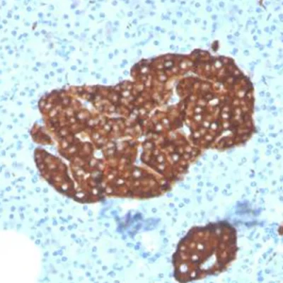 آنتی بادی Synaptophysin کلون 3551 برند PathoSage