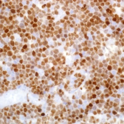 آنتی بادی TDT کلون MX010 برند PathoSage