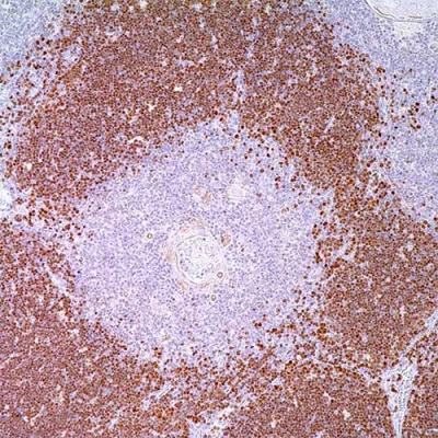 آنتی بادی TDT کلون Polyclonal برند PathoSage