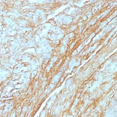 آنتی بادی Tenascin C کلون T2H5 برند PathoSage