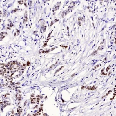 آنتی بادی TRPS1 کلون 8131R برند PathoSage
