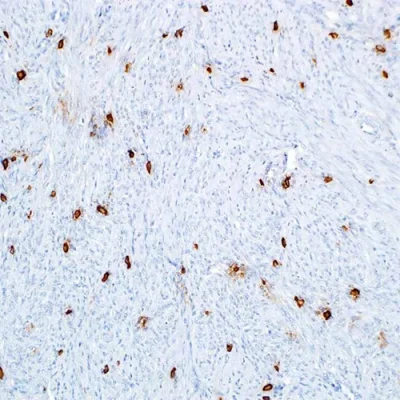 آنتی بادی Tryptase کلون G3 برند PathoSage