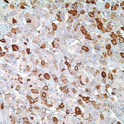 آنتی بادی TSH(Thyroid Stimulating Hormone) کلون Polyclonal برند PathoSage