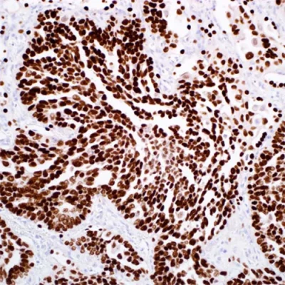آنتی بادی TTF1 کلون SPT24 برند PathoSage
