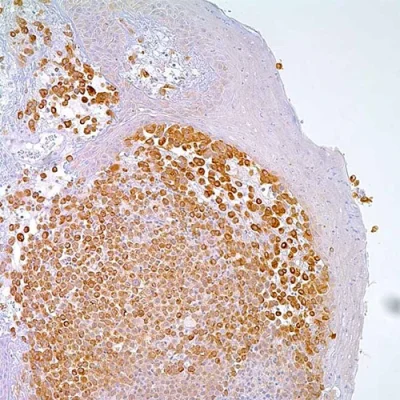 آنتی بادی Tyrosinase کلون T311 برند PathoSage