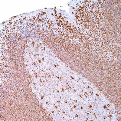 آنتی بادی Vimentin کلون V9 برند PathoSage