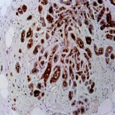 آنتی بادی Calretinin کلون MX027 برند PathoSage