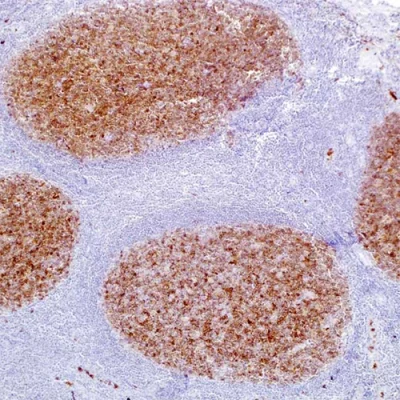 آنتی بادی CD10 کلون 56C6 برند PathoSage