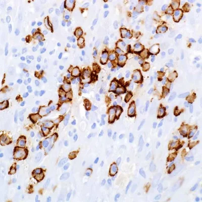 آنتی بادی CD138 کلون B-A38 برند PathoSage