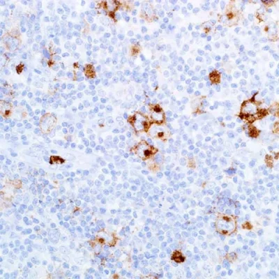 آنتی بادی CD15 کلون MMA برند PathoSage