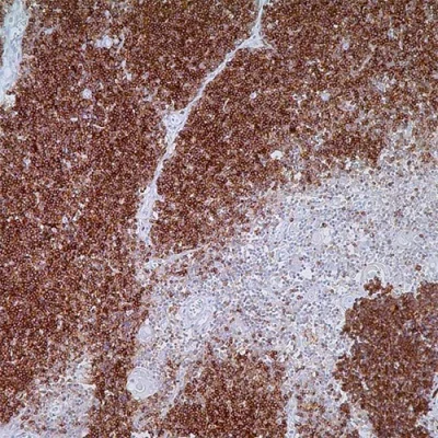 آنتی بادی CD1a کلون EP3622 برند PathoSage